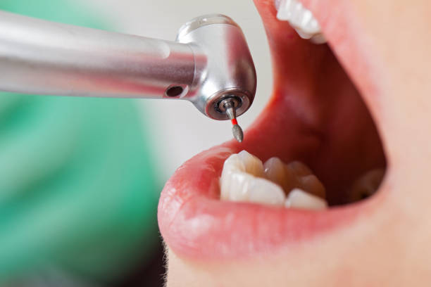Best Emergency Dental Care for Broken or Chipped Teeth in Village Of Four Seasons, MO